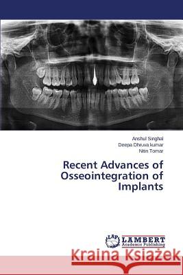 Recent Advances of Osseointegration of Implants