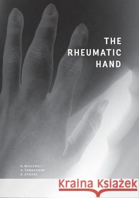 The Rheumatic Hand