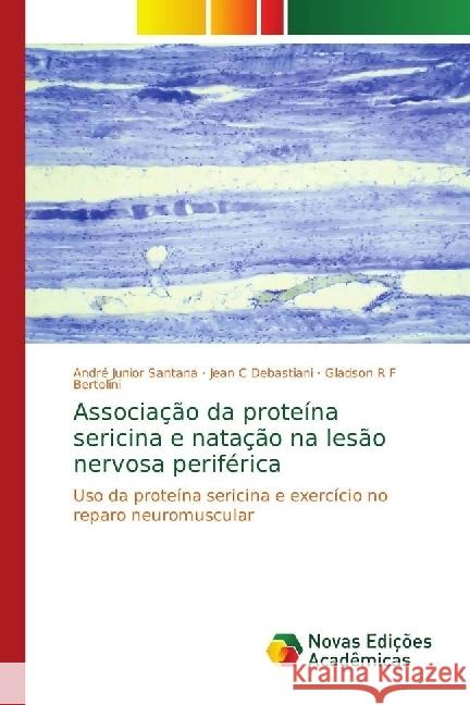 Associação da proteína sericina e natação na lesão nervosa periférica : Uso da proteína sericina e exercício no reparo neuromuscular