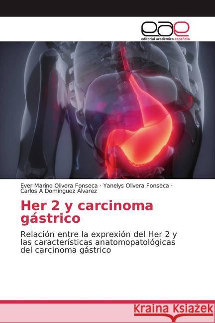 Her 2 y carcinoma gástrico : Relación entre la exprexión del Her 2 y las características anatomopatológicas del carcinoma gástrico