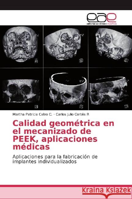 Calidad geométrica en el mecanizado de PEEK, aplicaciones médicas : Aplicaciones para la fabricación de implantes individualizados