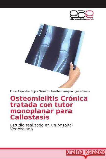 Osteomielitis Crónica tratada con tutor monoplanar para Callostasis : Estudio realizado en un hospital Venezolano