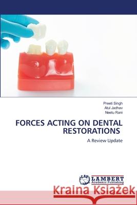 Forces Acting on Dental Restorations