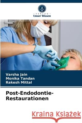 Post-Endodontie-Restaurationen