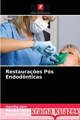 Restaurações Pós Endodônticas