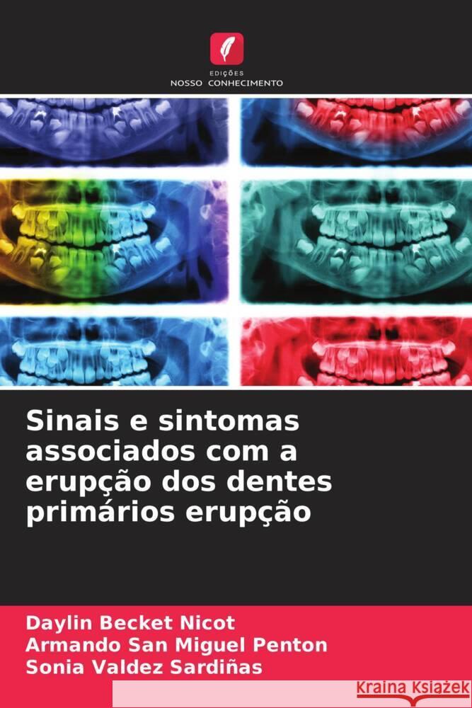 Sinais e sintomas associados com a erupção dos dentes primários erupção