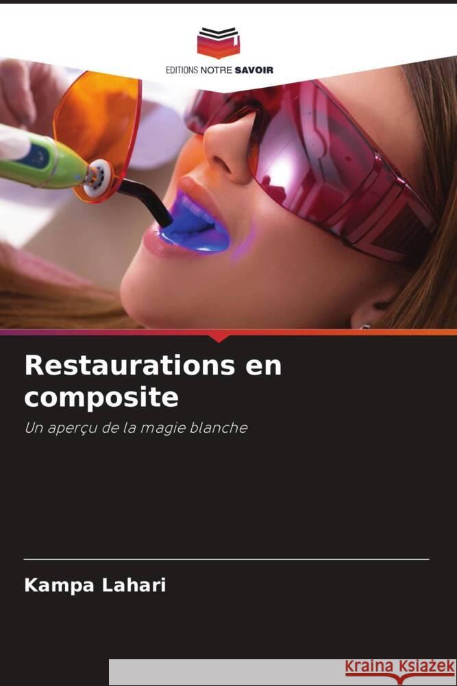 Restaurations en composite