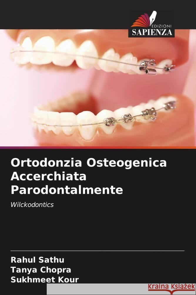 Ortodonzia Osteogenica Accerchiata Parodontalmente