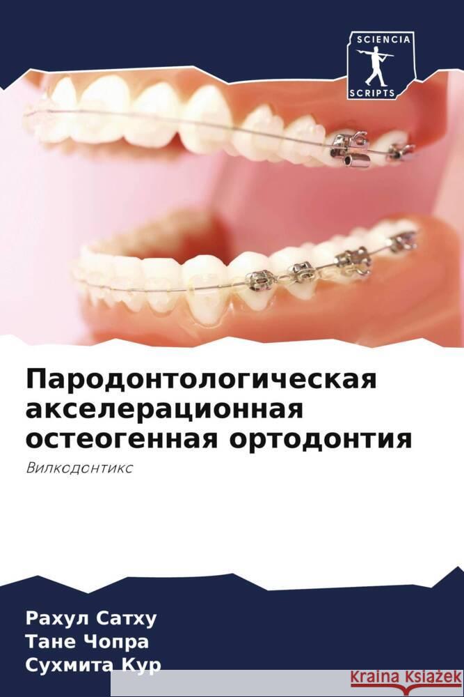 Parodontologicheskaq axeleracionnaq osteogennaq ortodontiq