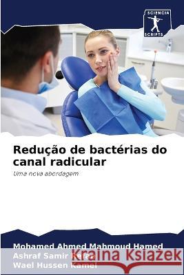 Redu??o de bact?rias do canal radicular