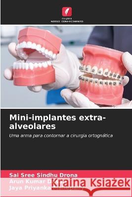 Mini-implantes extra-alveolares