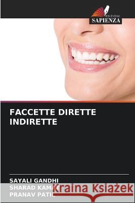 Faccette Dirette Indirette
