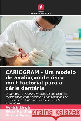CARIOGRAM - Um modelo de avaliacao de risco multifactorial para a carie dentaria