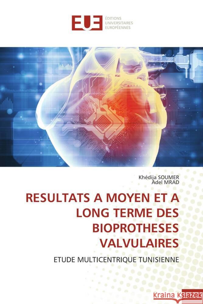 Resultats a Moyen Et a Long Terme Des Bioprotheses Valvulaires