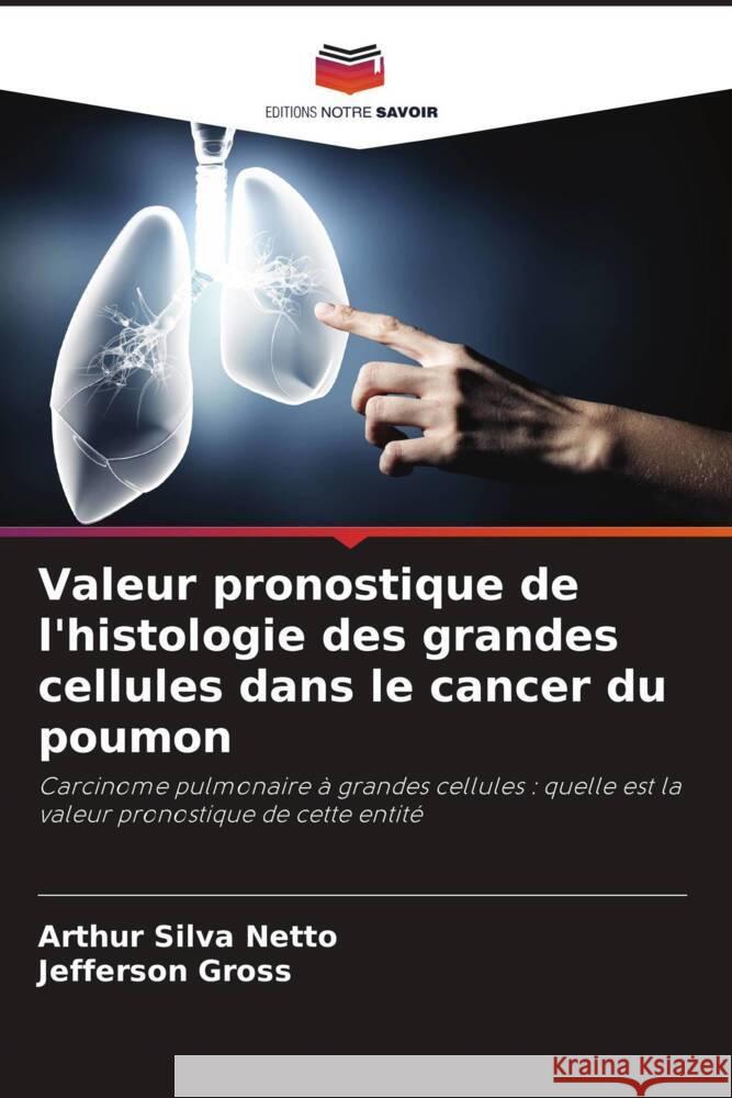 Valeur pronostique de l'histologie des grandes cellules dans le cancer du poumon