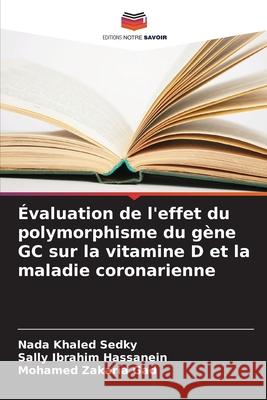 ?valuation de l'effet du polymorphisme du g?ne GC sur la vitamine D et la maladie coronarienne