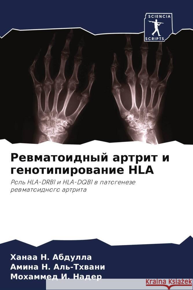 Rewmatoidnyj artrit i genotipirowanie HLA