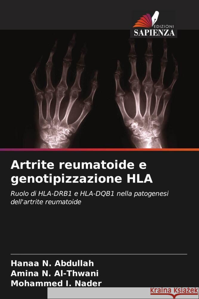 Artrite reumatoide e genotipizzazione HLA