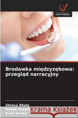 Brodawka międzyzębowa: przegląd narracyjny
