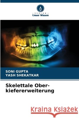 Skelettale Ober-kiefererweiterung