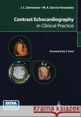 Contrast Echocardiography in Clinical Practice