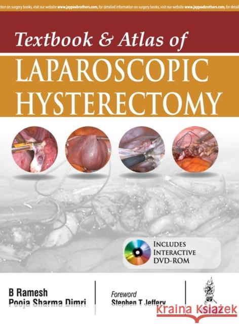 Textbook and Atlas of Laparoscopic Hysterectomy