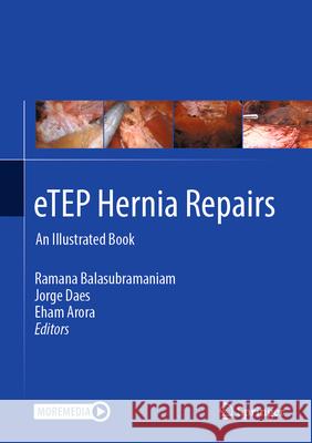Etep Hernia Repairs: An Illustrated Book