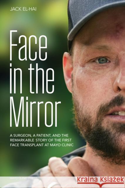 Face Transplant: How Medical Science Gave a Man a New Face and Restored His True Identity