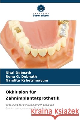 Okklusion f?r Zahnimplantatprothetik Nitai Debnath Renu G. Debnath Nandita Kshetrimayum 9786630096699 Verlag Unser Wissen - książka