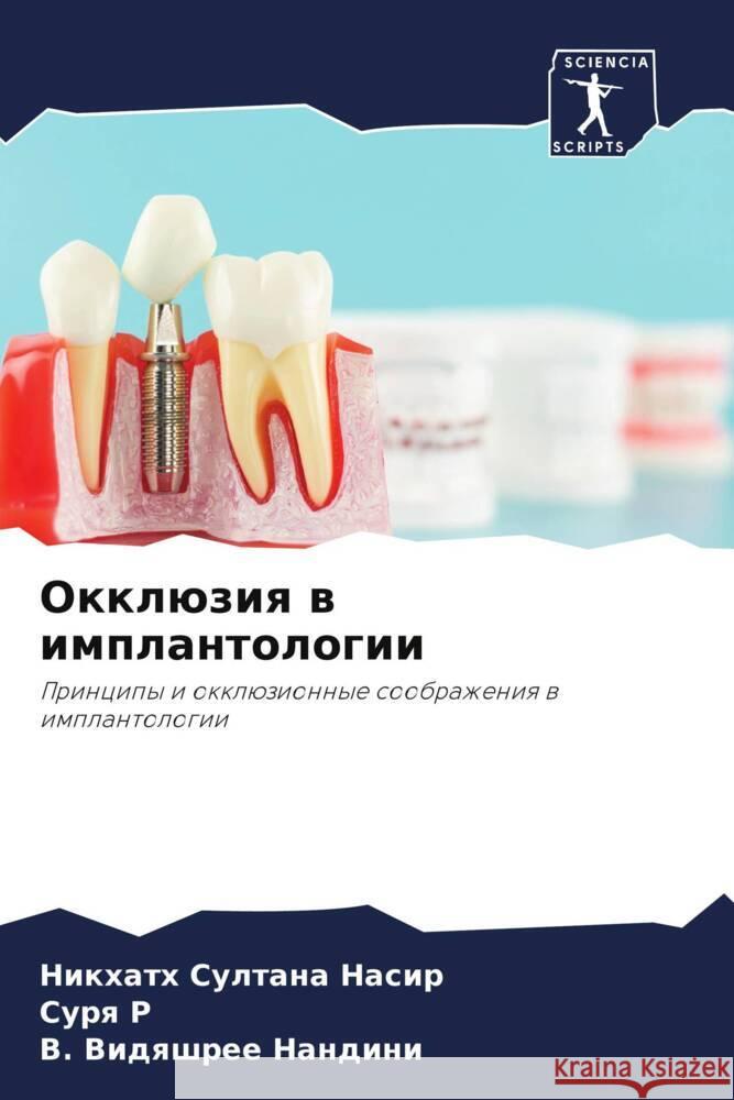Okklüziq w implantologii Sultana Nasir, Nikhath, R, Surq, Nandini, V. Vidqshree 9786204767437 Sciencia Scripts - książka
