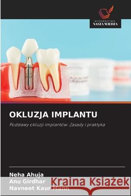 OKLUZJA IMPLANTU Ahuja, Neha, Girdhar, ANU, Kaur Mann, Navneet 9786208715748 Wydawnictwo Nasza Wiedza - książka