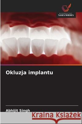 Okluzja implantu Singh, Abhijit 9786208898076 Wydawnictwo Nasza Wiedza - książka