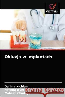 Okluzja w implantach Garima Nichlani Mridula Joshi Mahesh Ghadage 9786203523522 Wydawnictwo Nasza Wiedza - książka