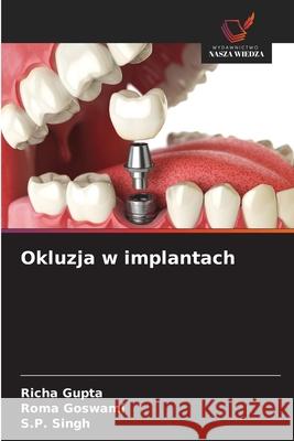 Okluzja w implantach Gupta, Richa, Goswami, Roma, Singh, S. P. 9786208937768 Wydawnictwo Nasza Wiedza - książka
