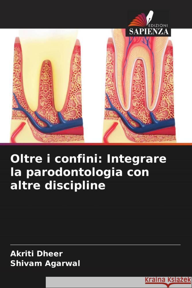 Oltre i confini: Integrare la parodontologia con altre discipline Dheer, Akriti, Agarwal, Shivam 9786208203221 Edizioni Sapienza - książka