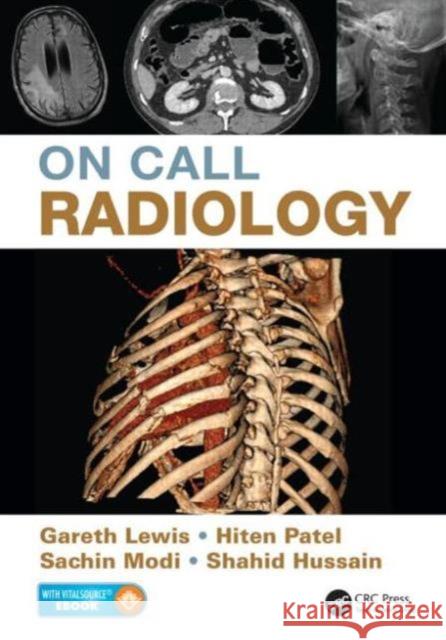 On Call Radiology Gareth Lewis 9781482221671 Apple Academic Press - książka