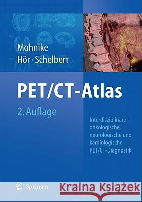 Oncologic and Cardiologic Pet/Ct-Diagnosis: An Interdisciplinary Atlas and Manual [With DVD ROM] Mohnike, Wolfgang 9783540740902 Not Avail - książka