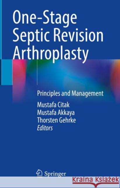 One-Stage Septic Revision Arthroplasty: Principles and Management Mustafa Citak Mustafa Akkaya Thorsten Gehrke 9783031591594 Springer - książka