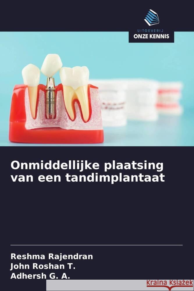Onmiddellijke plaatsing van een tandimplantaat Rajendran, Reshma, Roshan  T., John, G. A., Adhersh 9786208299835 Uitgeverij Onze Kennis - książka