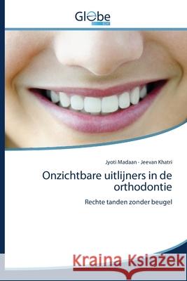 Onzichtbare uitlijners in de orthodontie Jyoti Madaan, Jeevan Khatri 9786139419623 Globeedit - książka