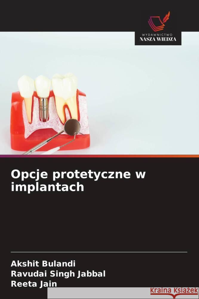 Opcje protetyczne w implantach Bulandi, Akshit, Jabbal, Ravudai Singh, Jain, Reeta 9786209466137 Wydawnictwo Nasza Wiedza - książka