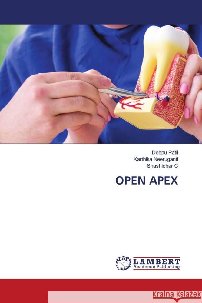 OPEN APEX Patil, Deepu, Neeruganti, Karthika, C, Shashidhar 9786200305336 LAP Lambert Academic Publishing - książka