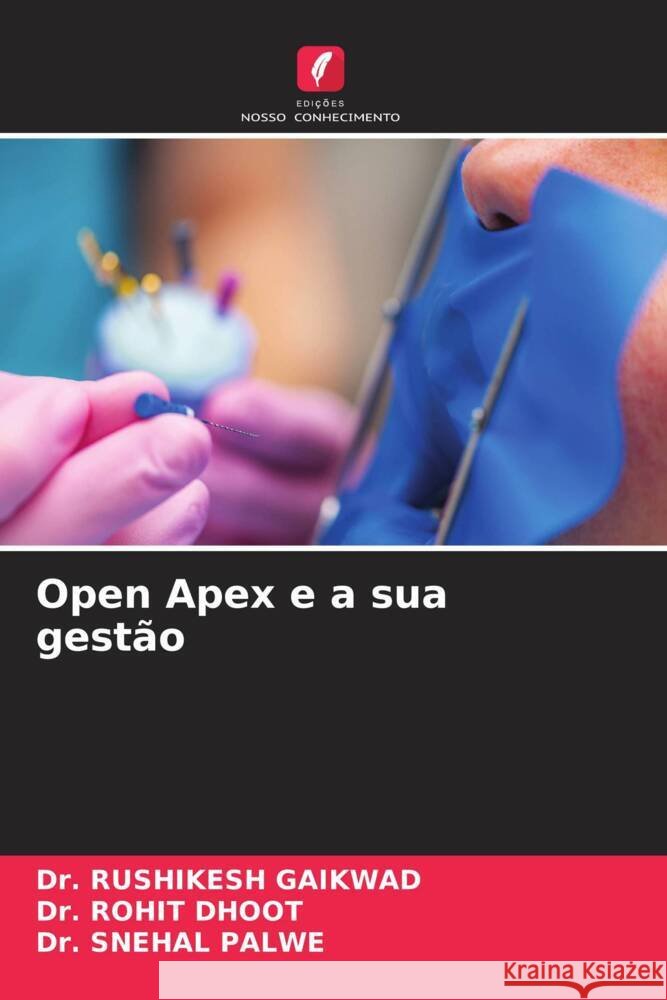Open Apex e a sua gest?o Rushikesh Gaikwad Rohit Dhoot Snehal Palwe 9786208110123 Edicoes Nosso Conhecimento - książka