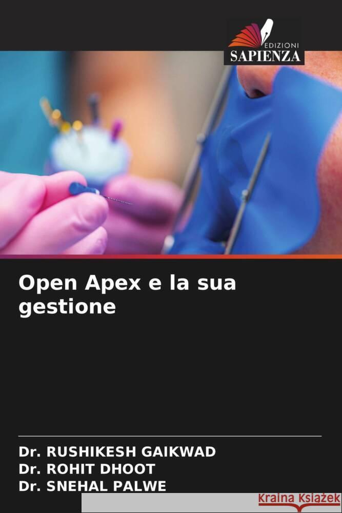 Open Apex e la sua gestione Rushikesh Gaikwad Rohit Dhoot Snehal Palwe 9786208110116 Edizioni Sapienza - książka