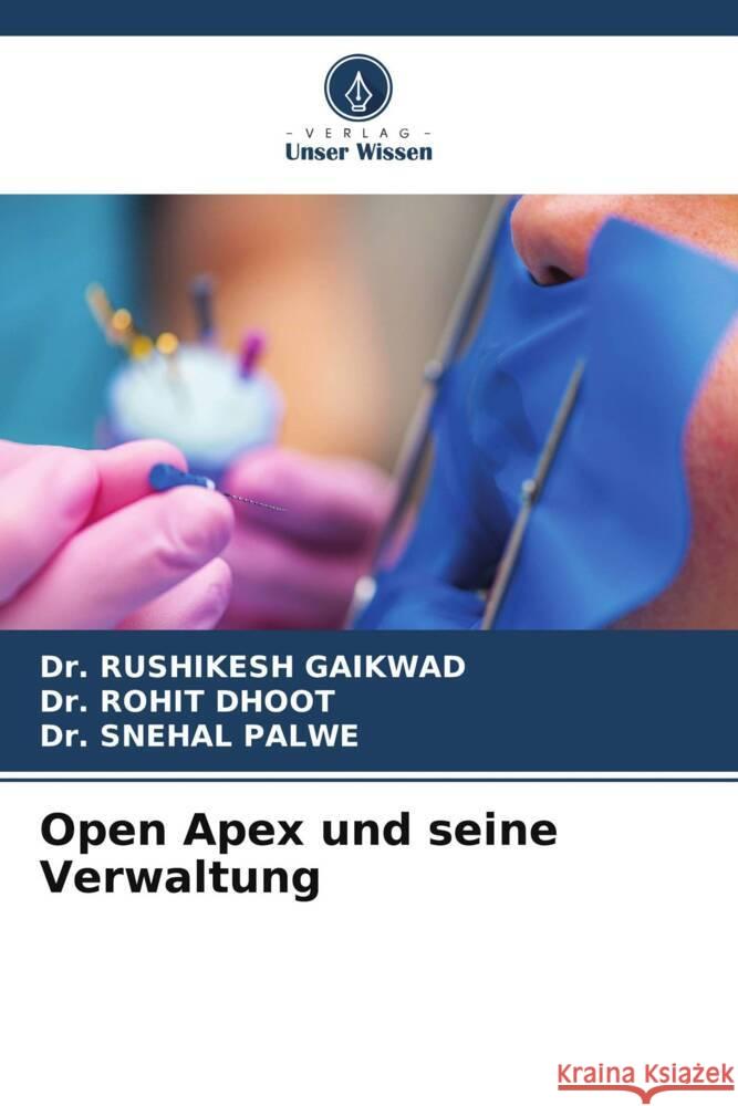 Open Apex und seine Verwaltung Rushikesh Gaikwad Rohit Dhoot Snehal Palwe 9786208110086 Verlag Unser Wissen - książka