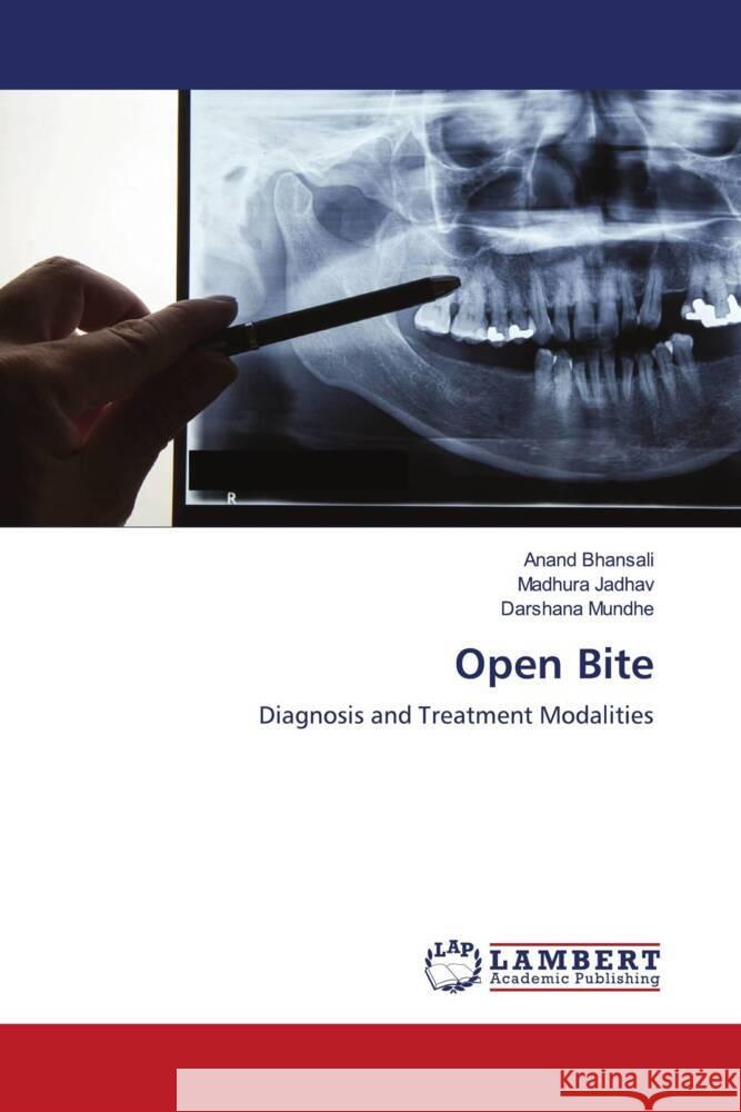 Open Bite Bhansali, Anand, Jadhav, Madhura, Mundhe, Darshana 9786204199160 LAP Lambert Academic Publishing - książka