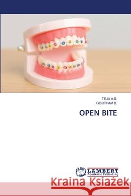 OPEN BITE A.S., TEJA, B., Goutham 9786208442255 LAP Lambert Academic Publishing - książka