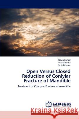 Open Versus Closed Reduction of Conlylar Fracture of Mandible Kumar Navin, Verma Arvind, Kumar Sushil 9783659183843 LAP Lambert Academic Publishing - książka