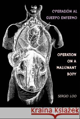 Operación al Cuerpo Enfermo / Operation on a Malignant Body Loo, Sergio 9781946031501 Kin(d* Texts & Projects - książka