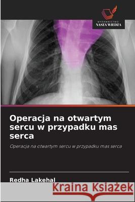 Operacja na otwartym sercu w przypadku mas serca Lakehal, Redha 9786209299513 Wydawnictwo Nasza Wiedza - książka